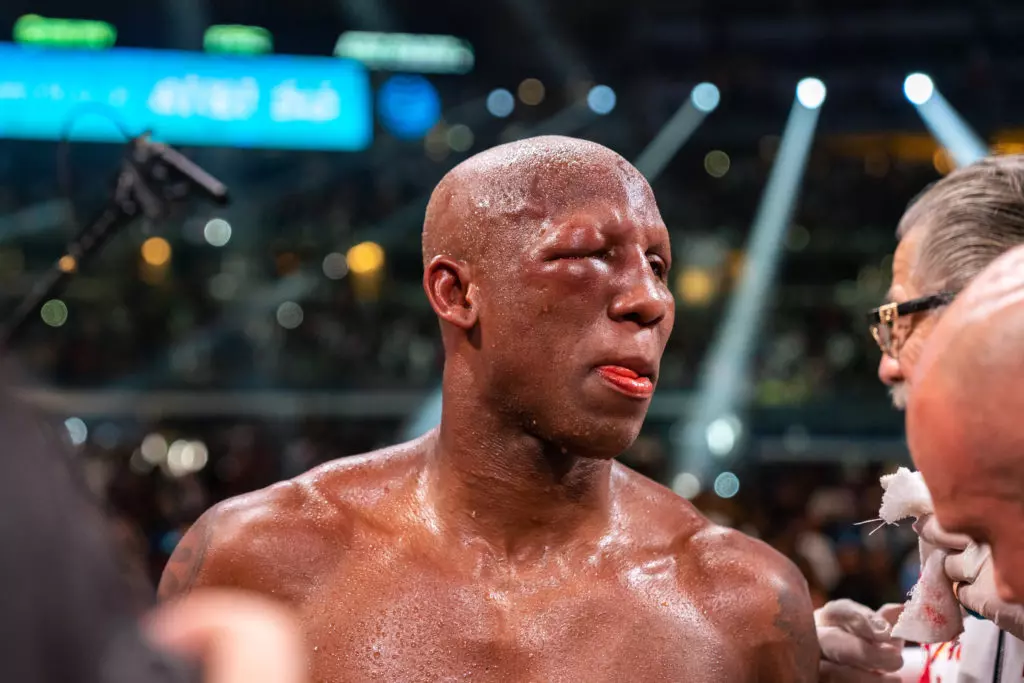 Yordenis Ugas Confirmed Fractured Eye Orbital In Spence Loss