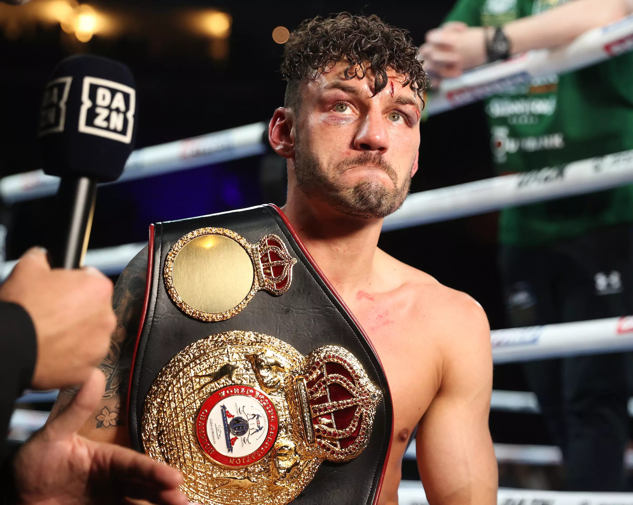 Leigh Wood Shows Boldness In Fighting Maurico Lara