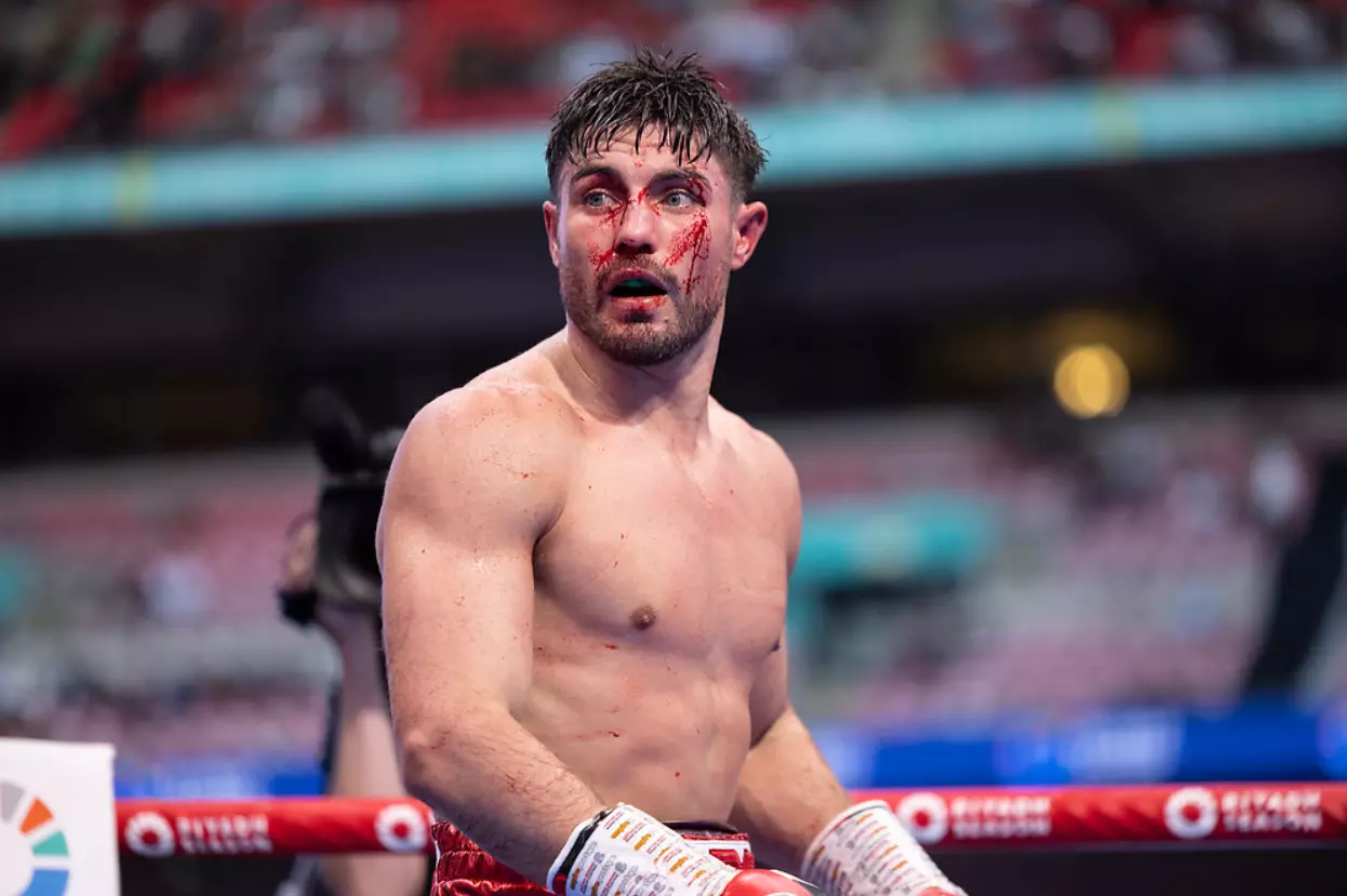 Frank Smith clarifies Josh Kelly’s promotional situation with Matchroom Boxing