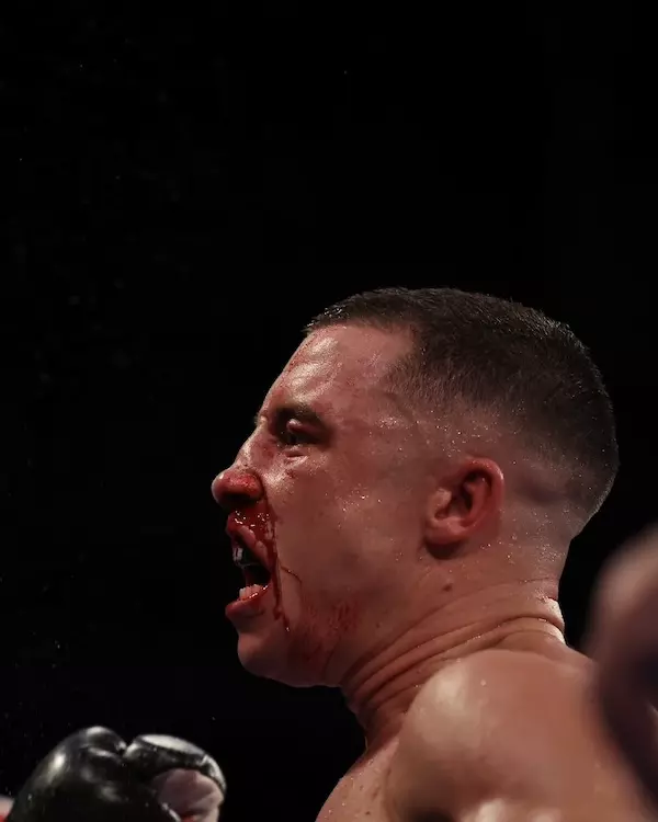 Frank Warren Talks Future Potential ‘Monster’ Fight for Nick Ball